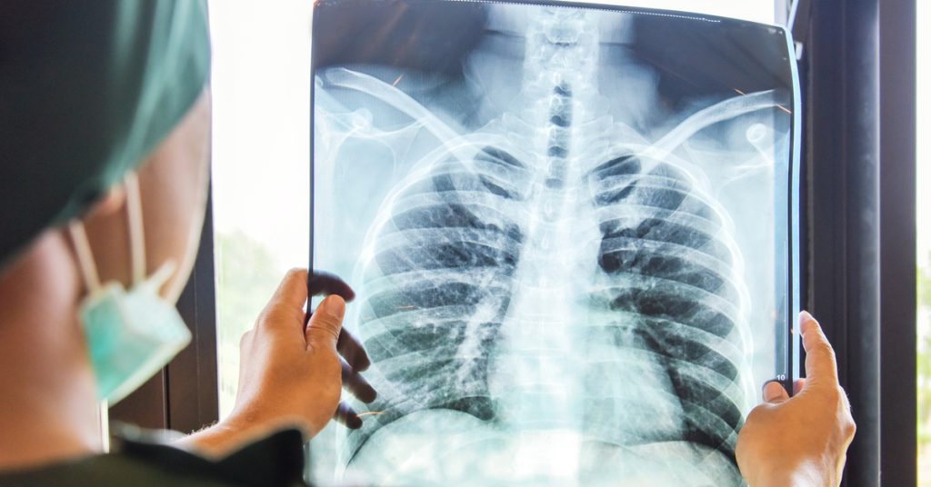 الخبير مصطفى الناجي: حليب البقر قد يحتوي على بكتيريا تتسبب في مرض السل