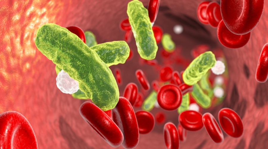 حمضي: تسمم الدم مشكلة صحية عمومية والوقاية منها عبر التشخيص المبكر