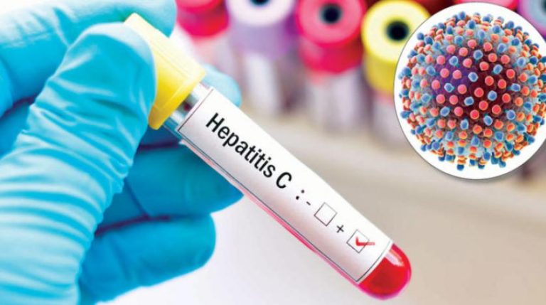 معدل انتشاره بـ 0.5 % .. وزارة الصحة تطلق أول حملة وطنية للكشف عن التهاب الكبد الفيروسي "س"