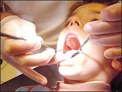 أمراض اللثة أول سبب لفقدان الأسنان في المغرب