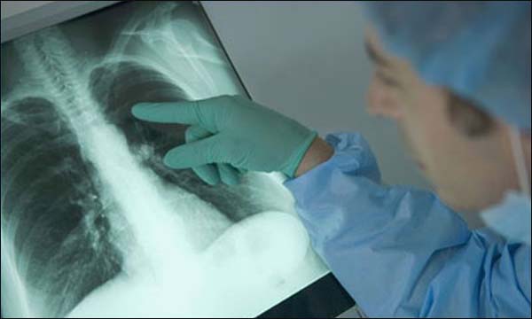 أيام علمية حول التدخين وسرطان الرئة والتكوين المستمر للأطباء