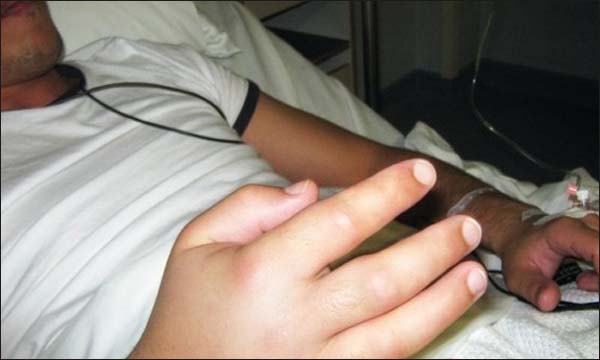 جهة طنجة تطوان في مقدمة المناطق الأكثر عرضة للسعات الأفاعي