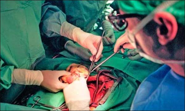 حملة توقيعات للترافع حول زراعة الكلي