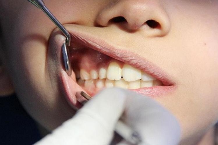 هيئة أطباء الأسنان تدين حادث مقتل طفل على يد ممارس غير قانوني للمهنة