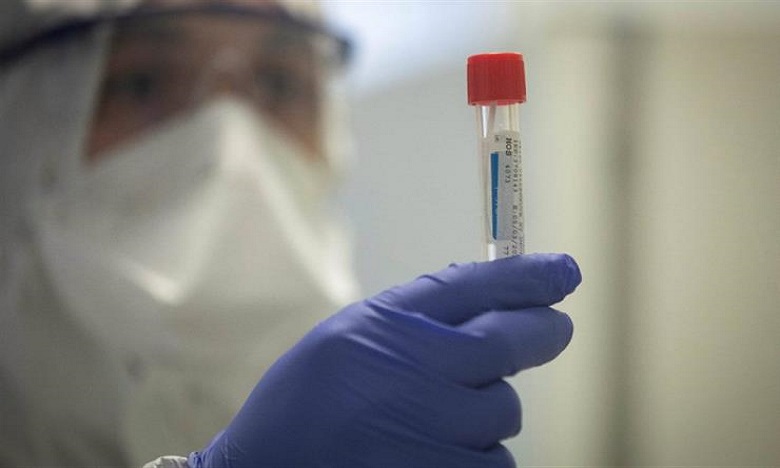 وزارة الصحة تتبنى المراقبة السيرولوجية للإصابة بعدوى فيروس "كوفيد 19"