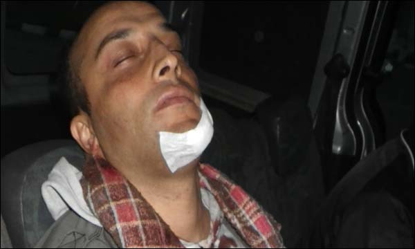 الشرطي ضحية الاعتداء (أيس بريس)