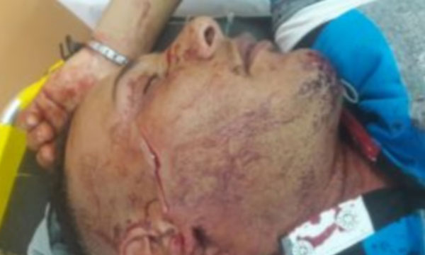 الاعتداء على مراقب حافلة النقل الحضرية بالجديدة