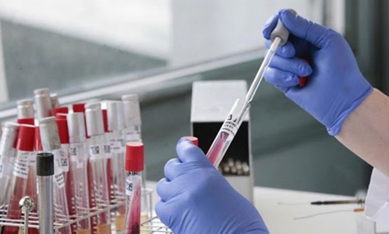 المختبرات المرجعية تواصل مهام الكشف عن "كوفيد19" بعد رفع الحجر الصحي