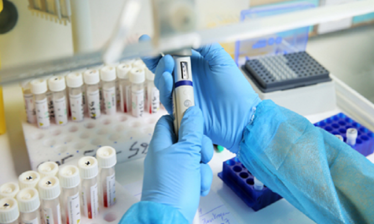 توسيع شبكة المختبرات الخاصة المسموح لها بإجراء اختبارات تشخيص فيروس كورونا