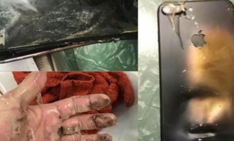 وزارة التربية الوطنية تتكفل بمصاريف علاج تلميذ تعرض لحادث انفجار بطارية هاتفه