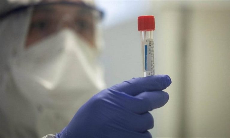 وزارة الصحة تتبنى المراقبة السيرولوجية للإصابة بعدوى فيروس "كوفيد 19"
