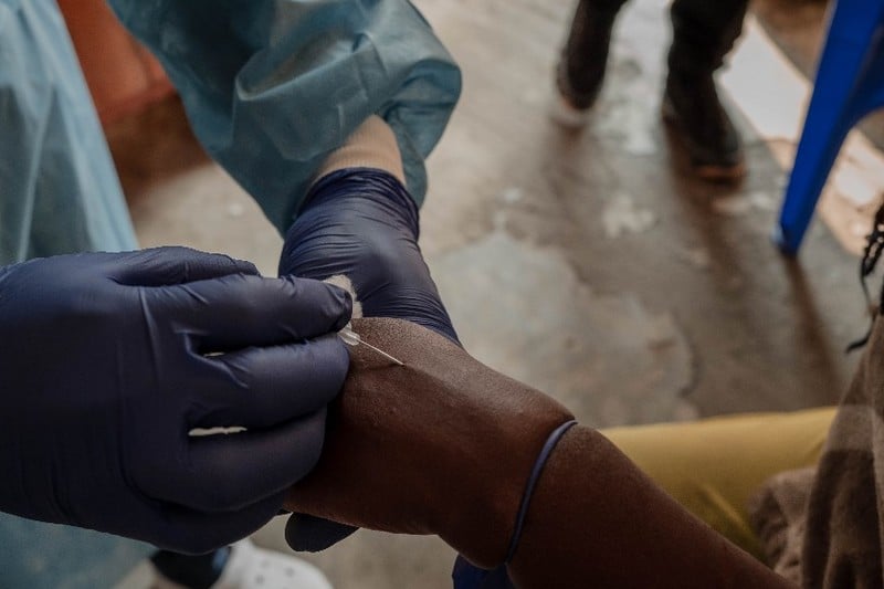 إفريقيا تسجل 18737 إصابة بجدري القردة إفريقيا تسجل 18737 إصابة بجدري القردة