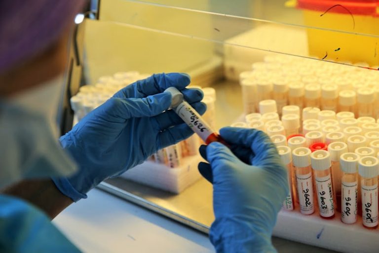 فيروس رئوي جديد يثير قلقا عالميا