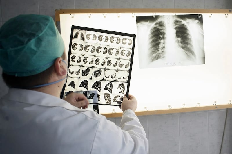 إسبانيا تشتكي من "حصبة المغرب" إسبانيا تشتكي من "حصبة المغرب"