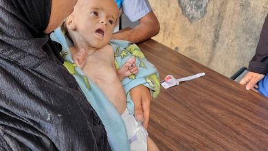 ثلث أطفال غزة يعانون سوء التغذية