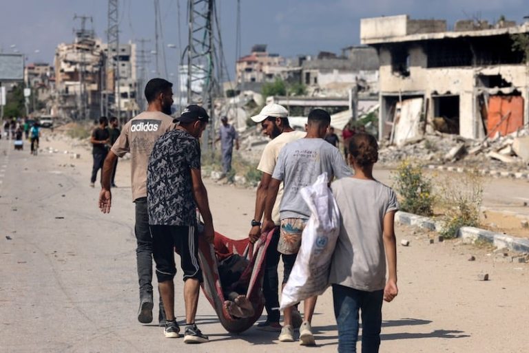 غزة تنعى 5 قتلى بسبب سوء التغذية