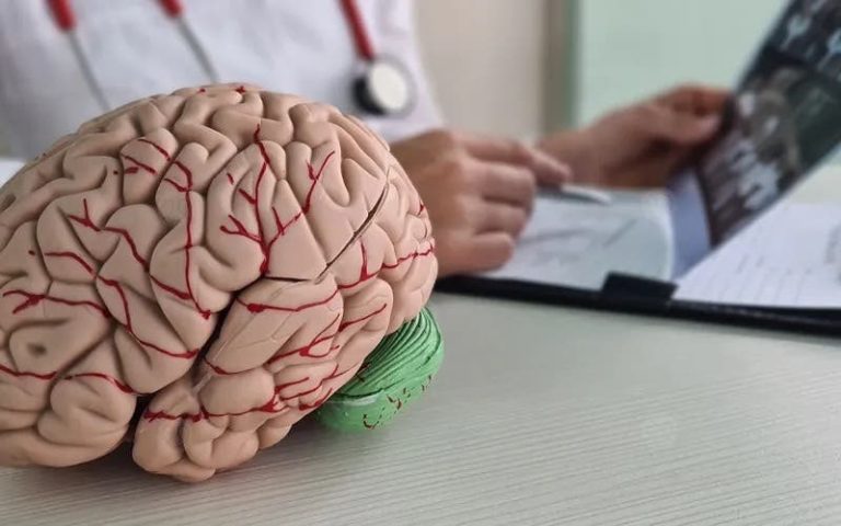 السكتة الدماغية تحصد أرواح 36 ألف مغربي في عام واحد السكتة الدماغية تحصد أرواح 36 ألف مغربي في عام واحد