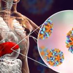 منظمة الصحة العالمية تصنف المغرب "دولة متحكمة" في التهاب الكبد B