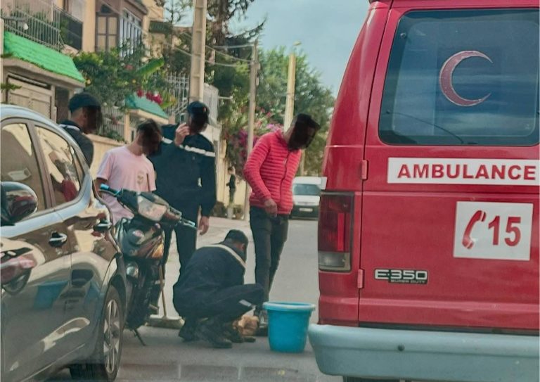تزنيت: كلب ضال يهاجم امرأة وفتاة ويحيلهما إلى المستشفى